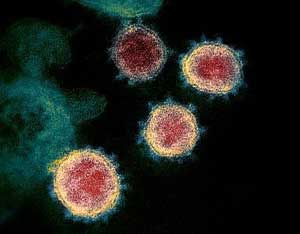 spherical covid viruses